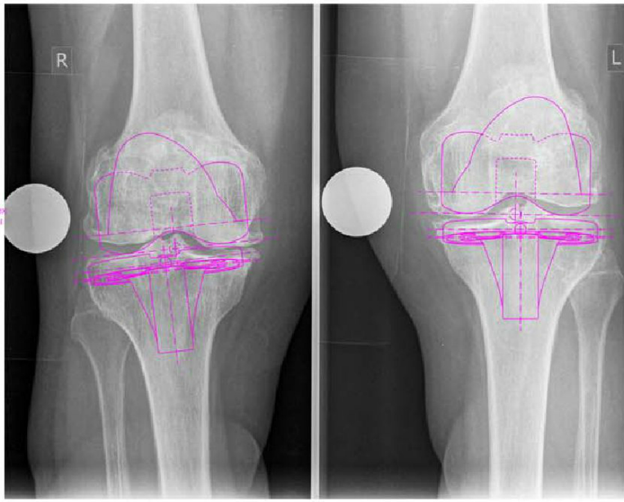 Coxa Nairi Clinic New Level In Orthopedics Of Armenia