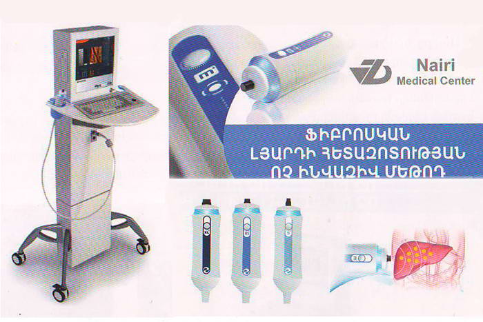 A non –invasive Fibroscan liver test