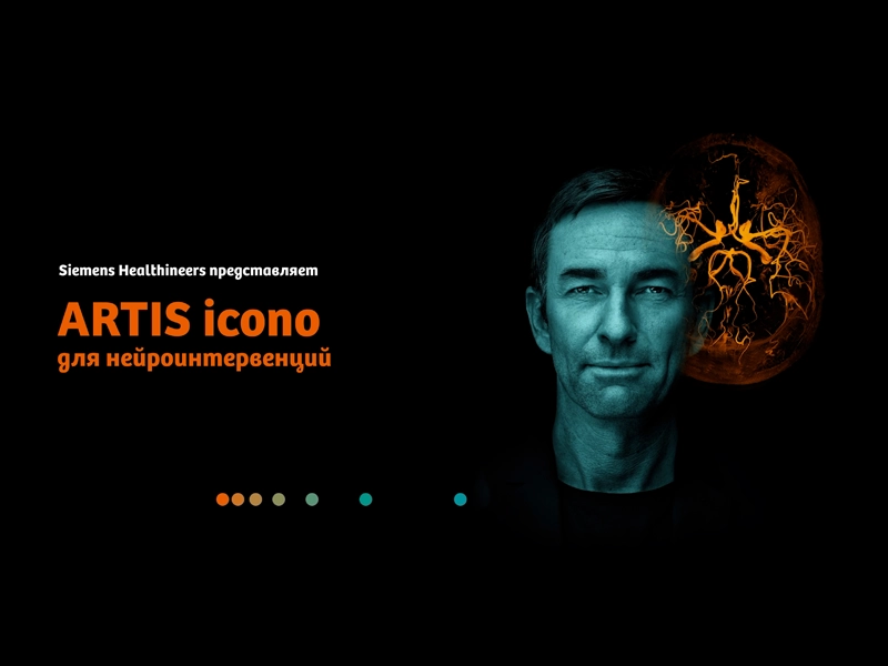 Siemens Healthineers has prepared a video about the Artis Icono angiography