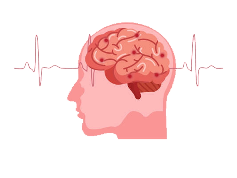 The 4 phases of stroke care