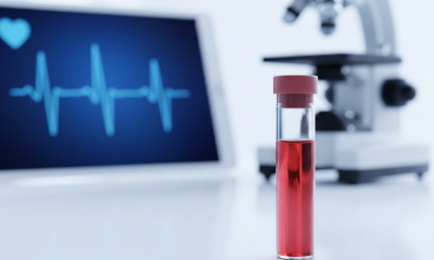 Key Diagnostic Tests for Early Detection of Prostate Cancer: PSA Test and Sonography