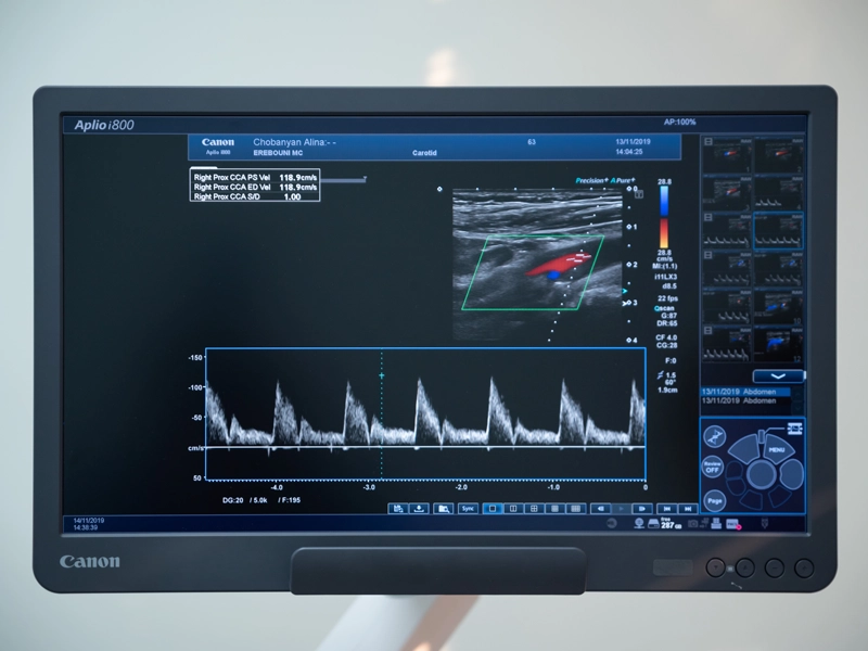 Ultrasound Diagnostics Service