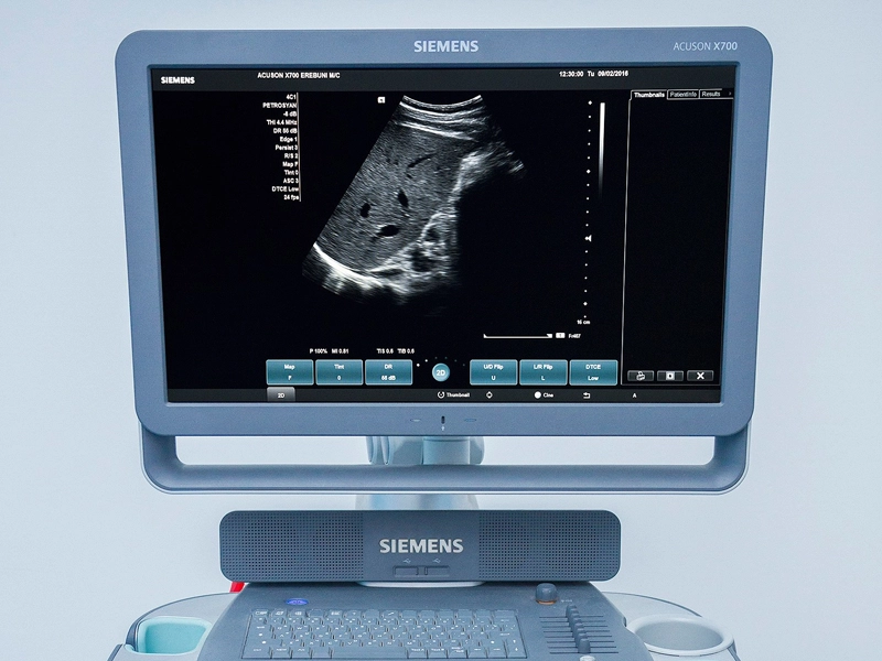 Ultrasound Diagnostics Service