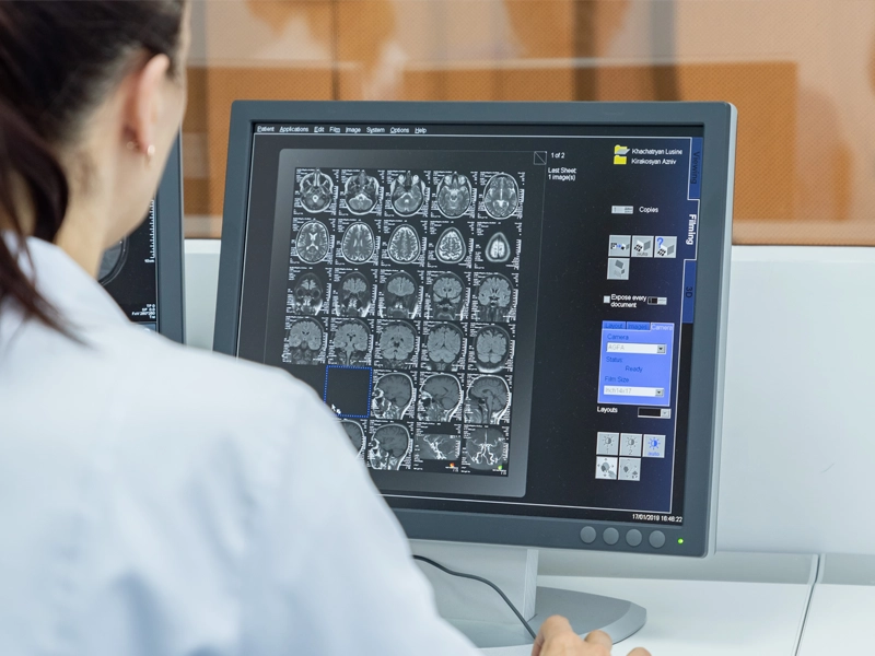 Magnetic Resonance Imaging (MRI) Service