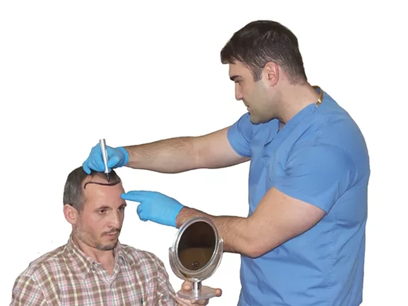 Hair Transplant Service