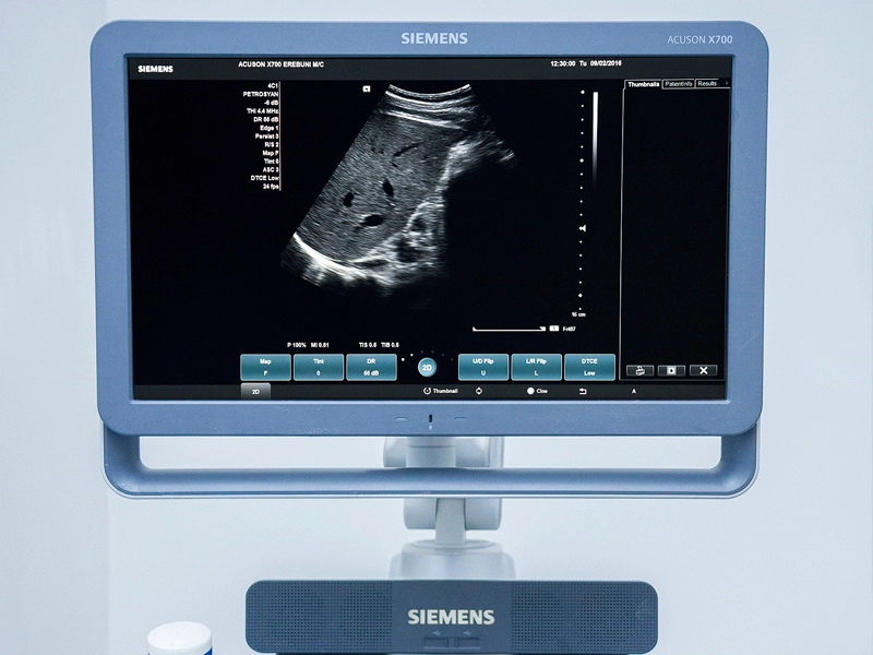 Cardiovascular Examination Service, Cardiology Center